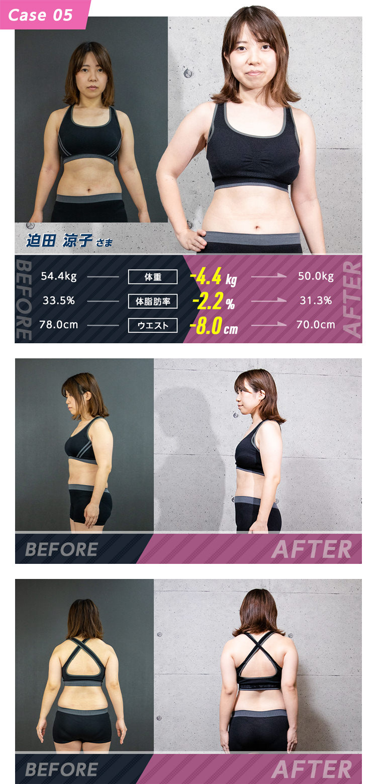 Case 05 迫田 涼子さま ビフォーアフター